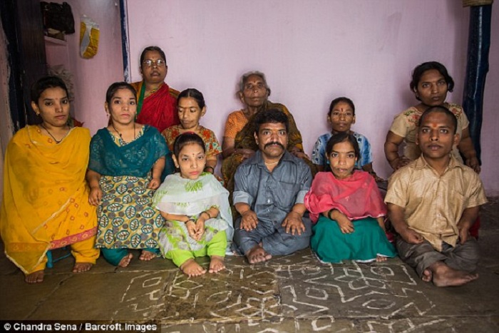 Indian dwarf family suffer the same genetic condition 